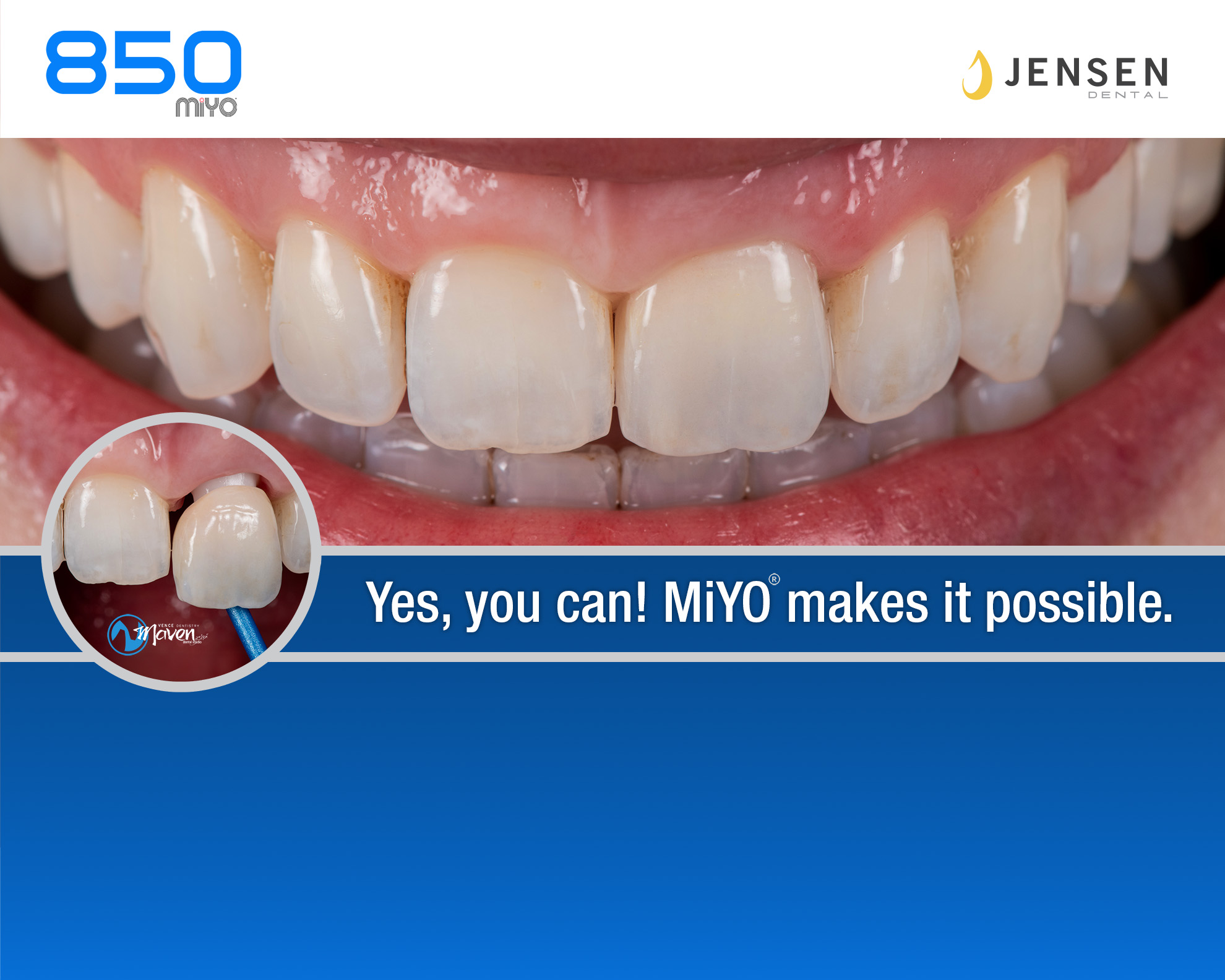 MiYO Booth at Sirona World 2024